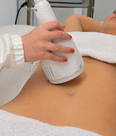 Aplicação de ponteira de radiofrequência corporal no abdômen de uma cliente durante sessão de estética para gordura localizada em Curitiba.