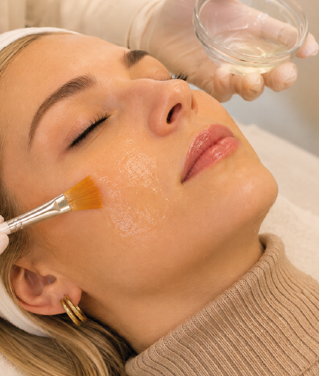Profissional aplicando solução de peeling facial com pincel na bochecha de uma paciente deitada com olhos fechados, durante procedimento estético em Curitiba.