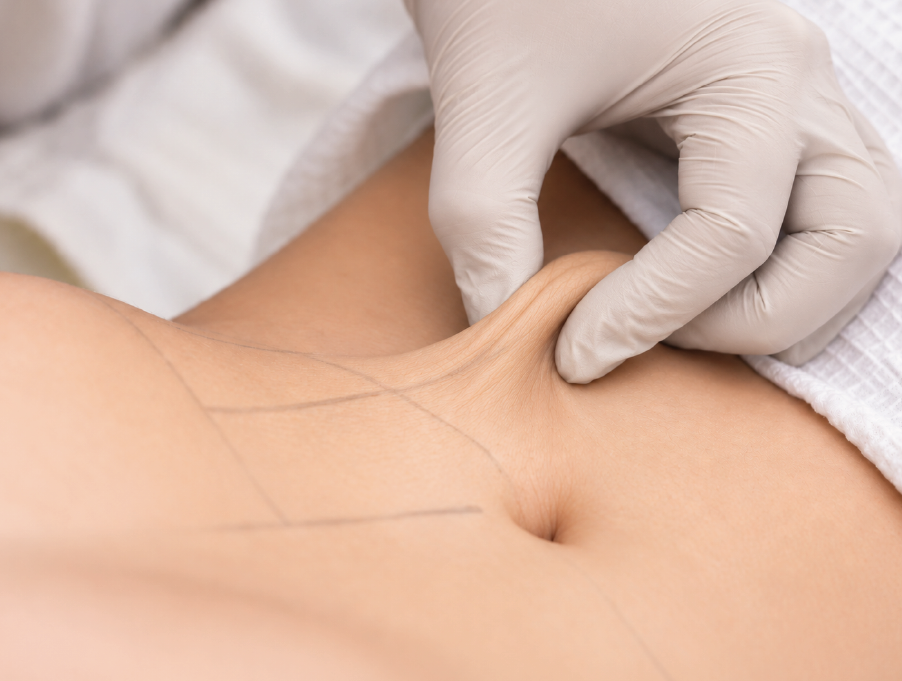 Esteticista avaliando flacidez corporal em paciente para tratamento na clínica de estética localizada em Curitiba